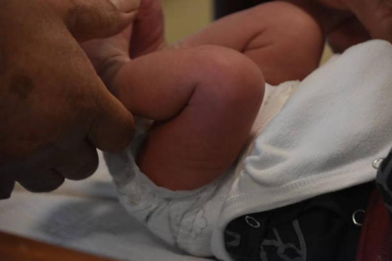Foto blog 3 Alasan Mengapa Sunat Lebih Disarankan saat Bayi, Simak Manfaatnya Menurut Pandangan Dokter!