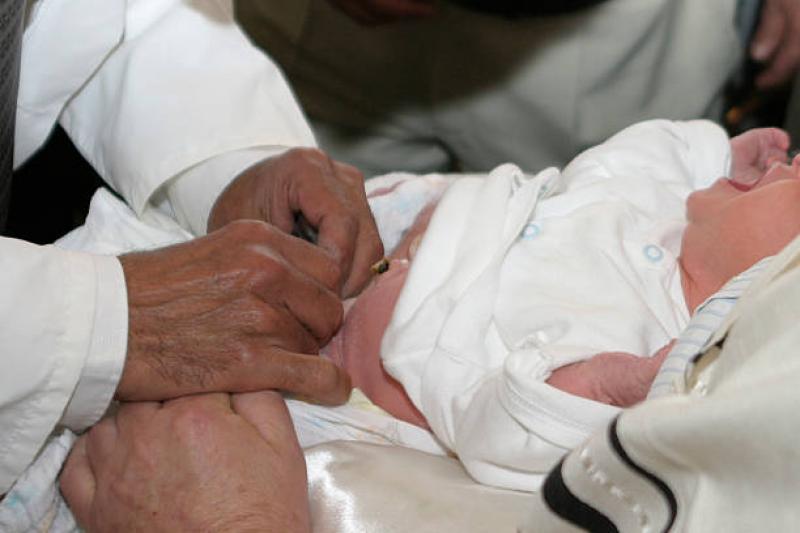 Foto blog Inilah Jawaban dari Keraguan Melakukan Sunat Pada Anak Saat Bayi