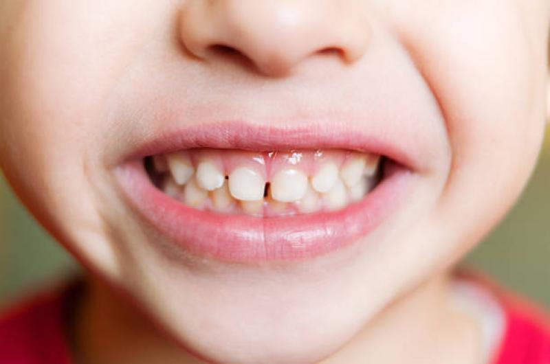 Penting Ajarkan Tentang Kesehatan Gigi dan Mulut pada Anak Sejak Dini